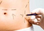 cirurgia-plastica-morumbi-1425404232