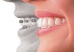 plano-odontologico-morumbi-1425425378